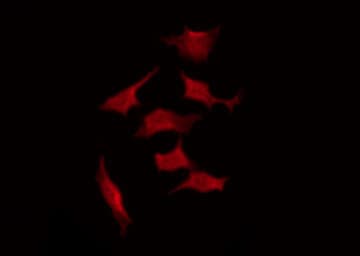 Polyclonal Rabbit anti-Human LYN Antibody (phospho-Tyr508, IHC, IF, WB)