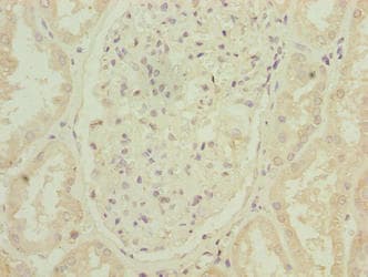 Polyclonal Rabbit anti-Human ARPIN / C15orf38 Antibody (IHC, WB)