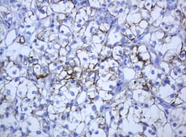 KRT5 / CK5 / Cytokeratin 5 Antibody (aa1-273, clone OTI1E7)