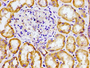 CHEMR23 / CMKLR1 Antibody