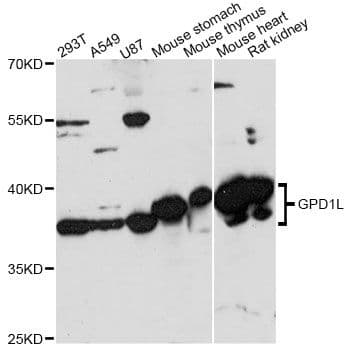Polyclonal Rabbit anti-Human GPD1L Antibody (WB)