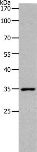 MC2R / ACTHR / ACTH Receptor Antibody
