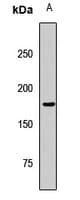 KDM5B / JARID1B Antibody