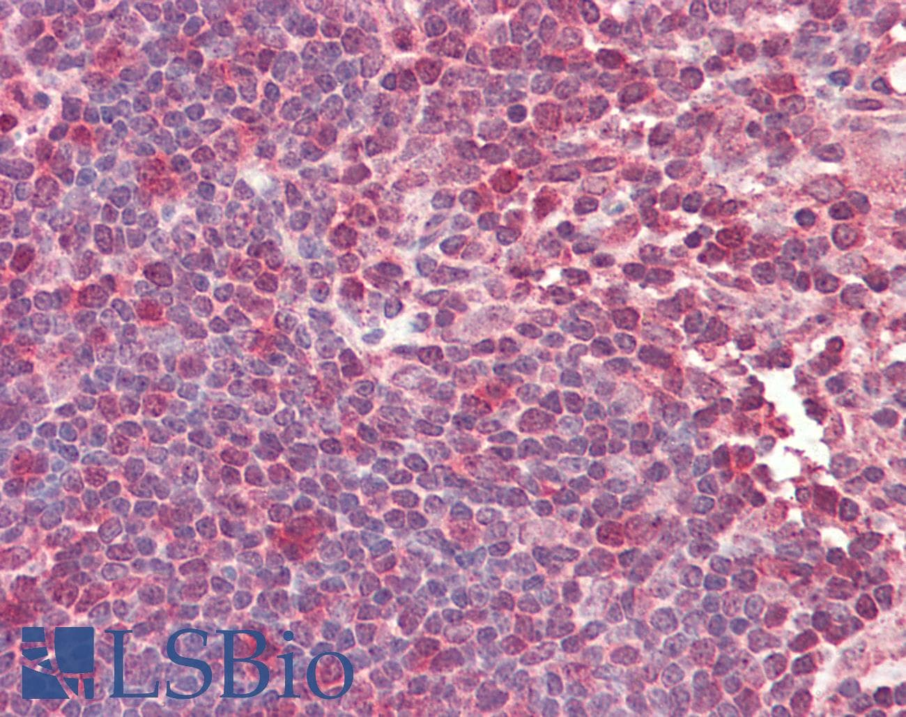 TCF12 / HEB Antibody (N-Terminus)