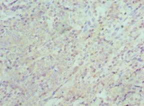 Polyclonal Rabbit anti-Human XIAP Antibody (aa1-200, IHC, WB)