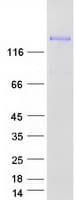 Human LIMCH1 Protein (Recombinant Myc-DDK (Flag))