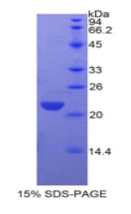 Human CLEC3B / Tetranectin Protein (Recombinant His)