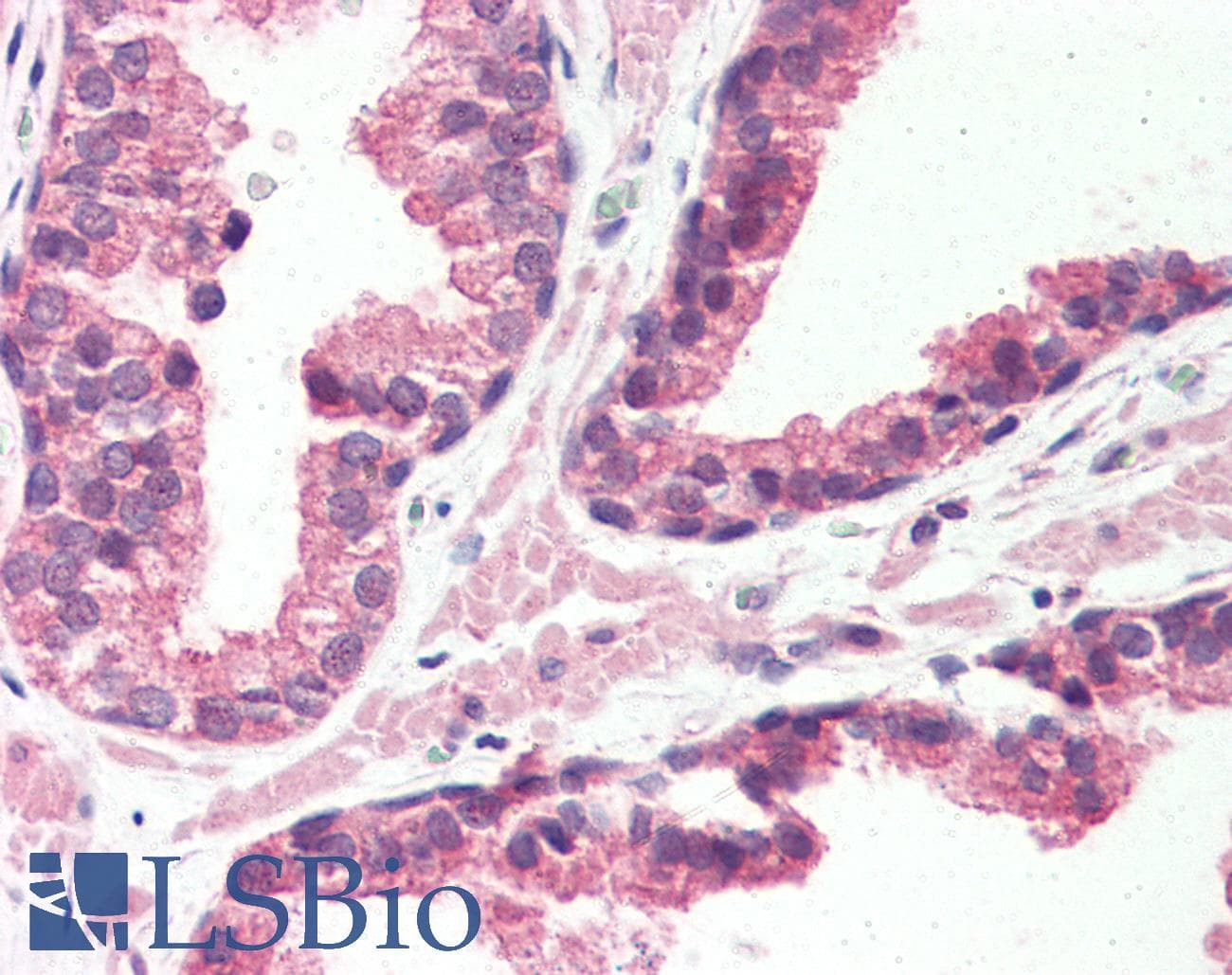 IHC-plus™ ADGRG6 / GPR126 Antibody (N-Terminus)