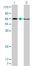 IHC-plus™ Monoclonal Mouse anti-Human HDAC1 Antibody (clone 5C11, IHC, IF, WB)