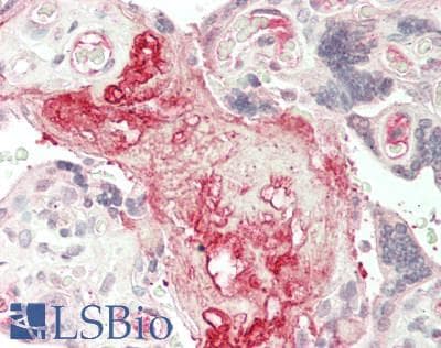 IHC-plus™ IL7R / CD127 Antibody