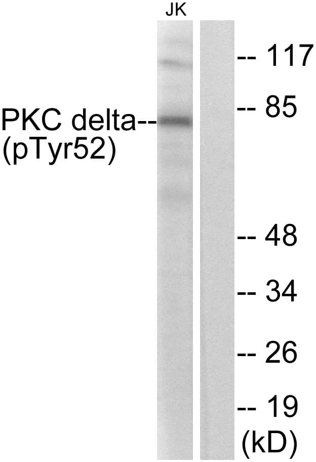 Polyclonal Rabbit anti-Human PRKCD / PKC-Delta Antibody (phospho-Tyr52, IHC, IF, WB)