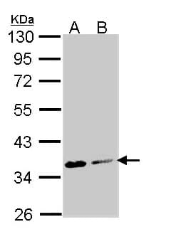 IHC-plus™ ASPA Antibody (aa39-300)