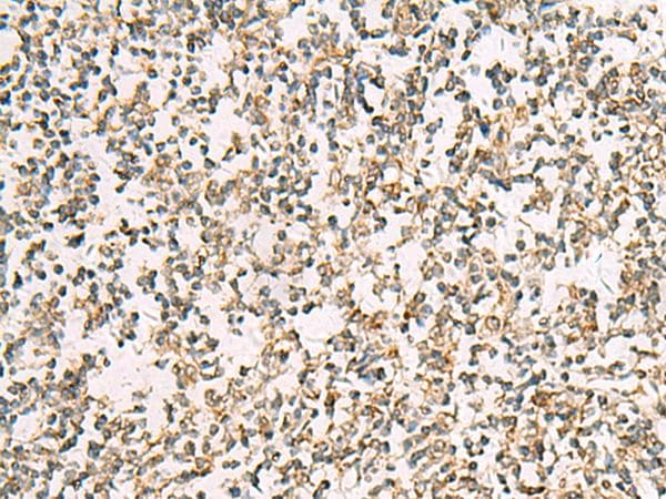 ZPBP2 Antibody