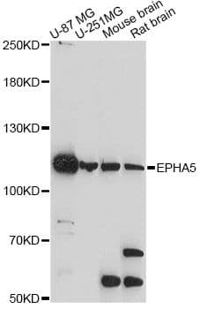 EPHA5 / EPH Receptor A5 Antibody