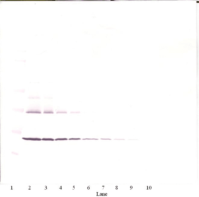 Polyclonal Rabbit anti-Human TNFRSF11A / RANK Antibody (WB)