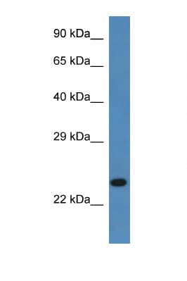 SSR2 Antibody (aa99-148)