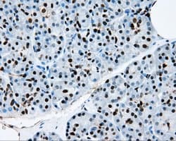 RPA2 / RFA2 / RPA34 Antibody (clone OTI9A1)