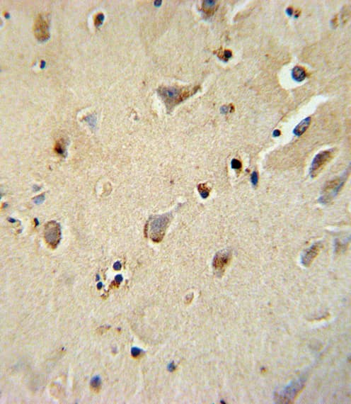 Polyclonal Rabbit anti-Human ATP1B1 Antibody (aa112-138, IHC, WB)