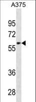 ZNF394 Antibody (aa287-316)