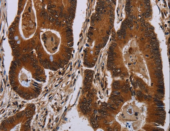 DCAF6 / NRIP Antibody