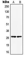 HOXB5 Antibody (Internal)