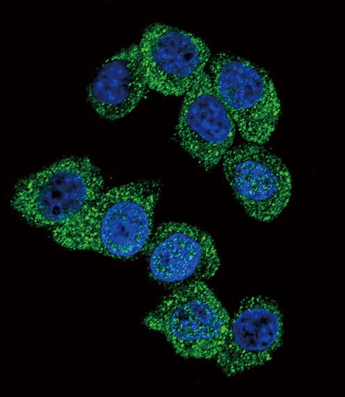 Polyclonal Rabbit anti-Human PGK1 / Phosphoglycerate Kinase Antibody (aa117-145, IHC, IF, WB)