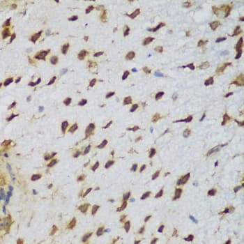 NCL / Nucleolin Antibody