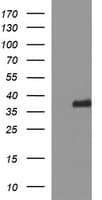 SYP / Synaptophysin Antibody (clone OTI3B12)