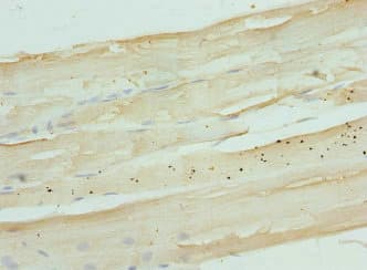 Polyclonal Rabbit anti-Human NDRG2 Antibody (IHC, WB)