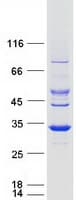 Human SDR9C7 Protein (Recombinant Myc-DDK (Flag))