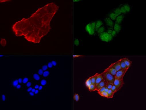 GBA / Glucosidase Beta Acid Antibody (aa40-315, clone UMAB171)