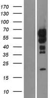 C15orf27 Protein (Over-Expression Lysate Myc-DDK (Flag))