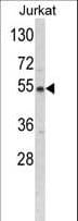 BCKDHA / BCKDE1A Antibody (aa362-390)