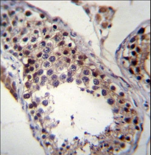 Polyclonal Rabbit anti-Human SPATA19 Antibody (aa122-150, IHC, WB)
