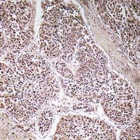 ATP5C1 Antibody (Internal)