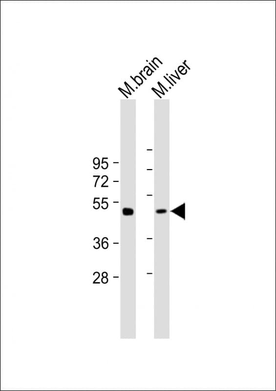 TUBG2 / Tubulin Gamma 2 Antibody