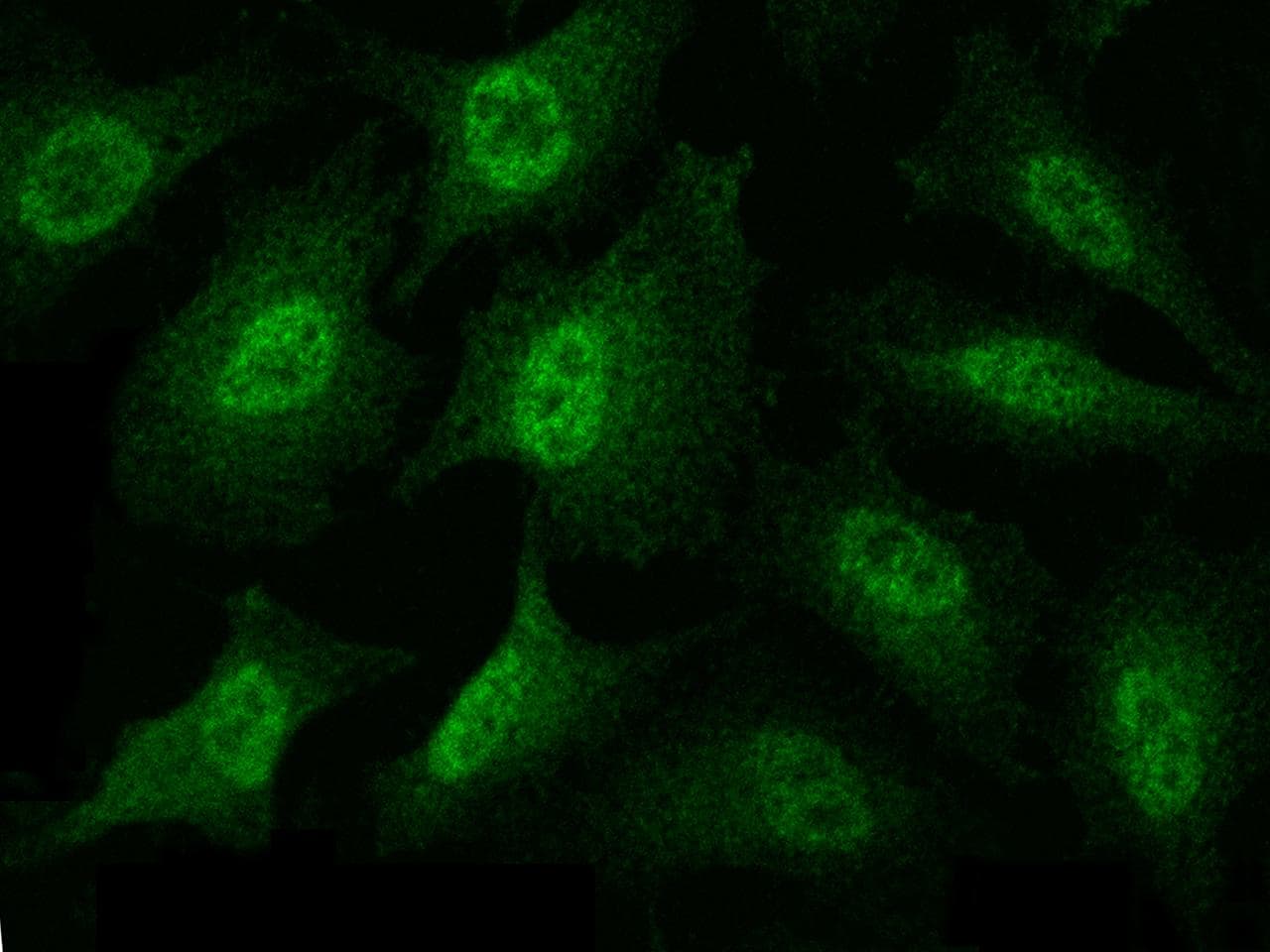 MAP2K3 / MEK3 / MKK3 Antibody (Preservative Free)