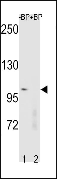 CTNNB1 / Beta Catenin Antibody (aa78-106)