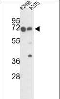 IHC-plus™ FKBP10 / FKBP65 Antibody (aa552-580)