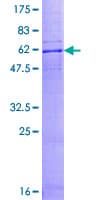 Human CCR10 / GPR2 Protein (Recombinant GST)