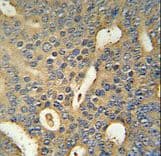 MICALL1 / MICAL-L1 Antibody (aa752-781)