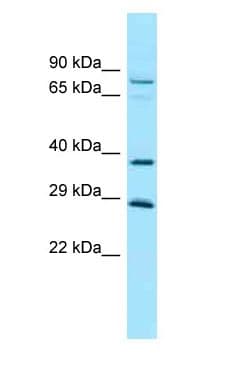 CCN4 / WISP1 Antibody (aa160-209)