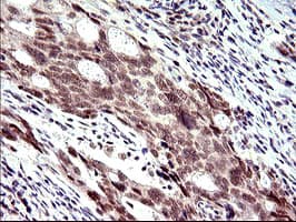 Monoclonal Mouse anti-Human PMS2 Antibody (clone OTI4B7, IHC, WB)