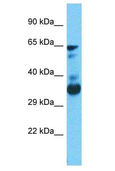 FANCC Antibody (aa98-147)
