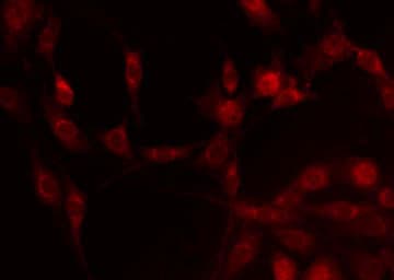 NDUFA4L2 Antibody
