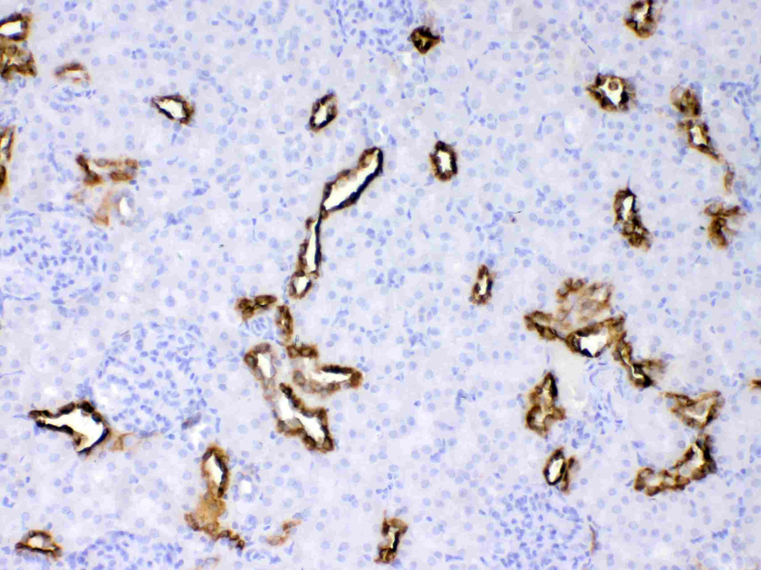 KRT18 / CK18 / Cytokeratin 18 Antibody