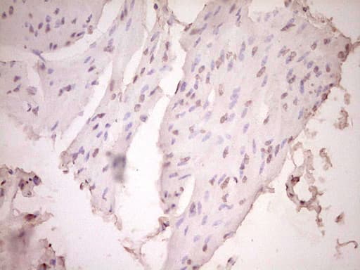PLAT / TPA Antibody (aa157-426, clone OTI3H3)