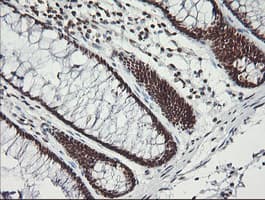 MCTS1 Antibody (aa1-181, clone OTI2F9)