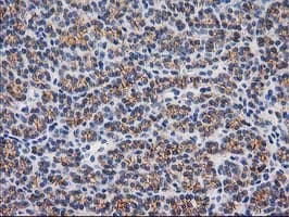 CTNNB1 / Beta Catenin Antibody (clone OTI6A3)