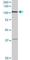 CCDC132 Antibody (clone 2D11)